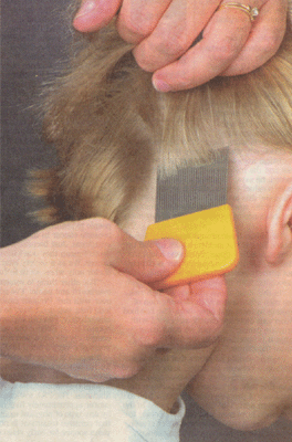 headlice head lice, Academy of Pediatrics